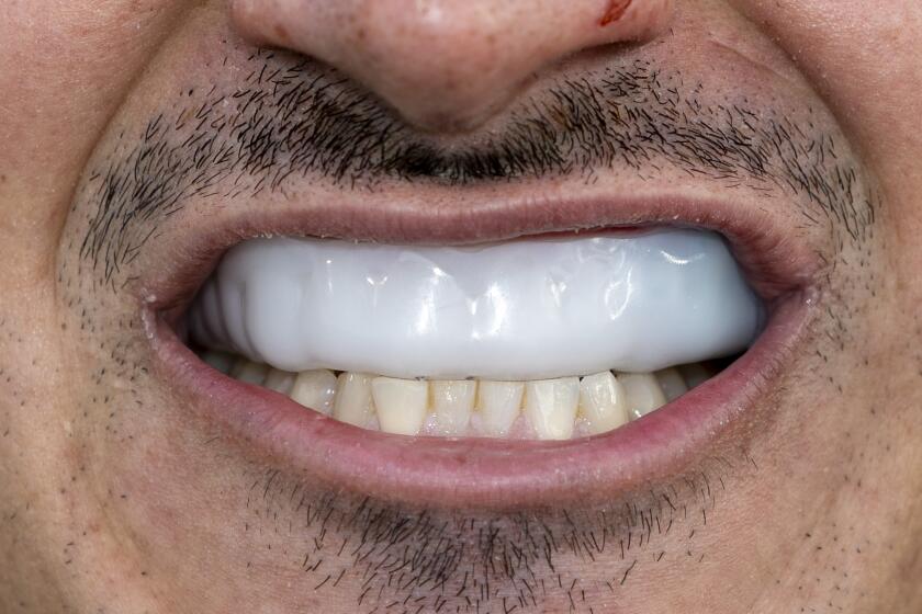 A rugby player displays his mouthguard.