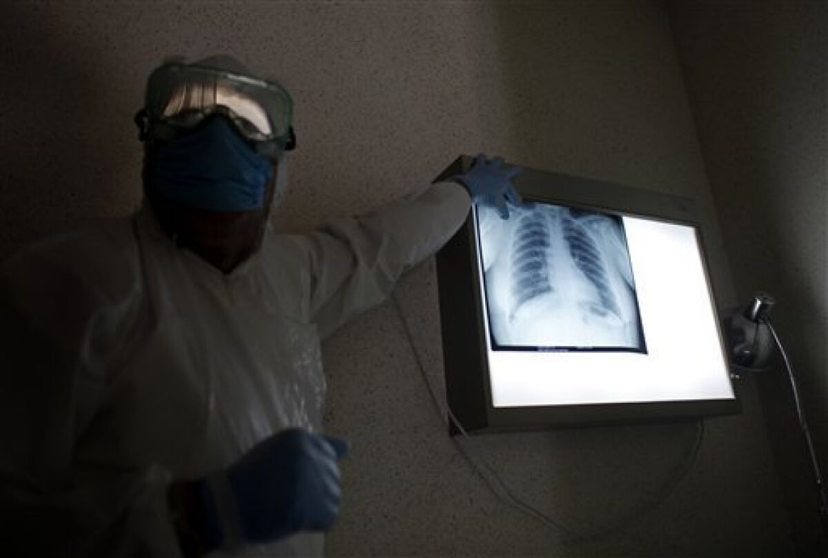 Navy Doctor Captain Manuel Velasco displays a patient's lung x-ray against a light box in the area where people suspected to have contracted the swine flu virus are treated at the Naval hospital in Mexico City, Sunday, May 3, 2009. (AP Photo/Dario Lopez-Mills)