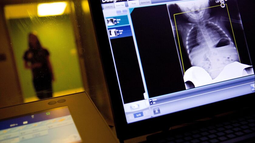 A radiology technician looks at a chest X-ray of a child suffering from flu symptoms at Upson Regional Medical Center in Thomaston, Ga., Friday, Feb. 9, 2018.