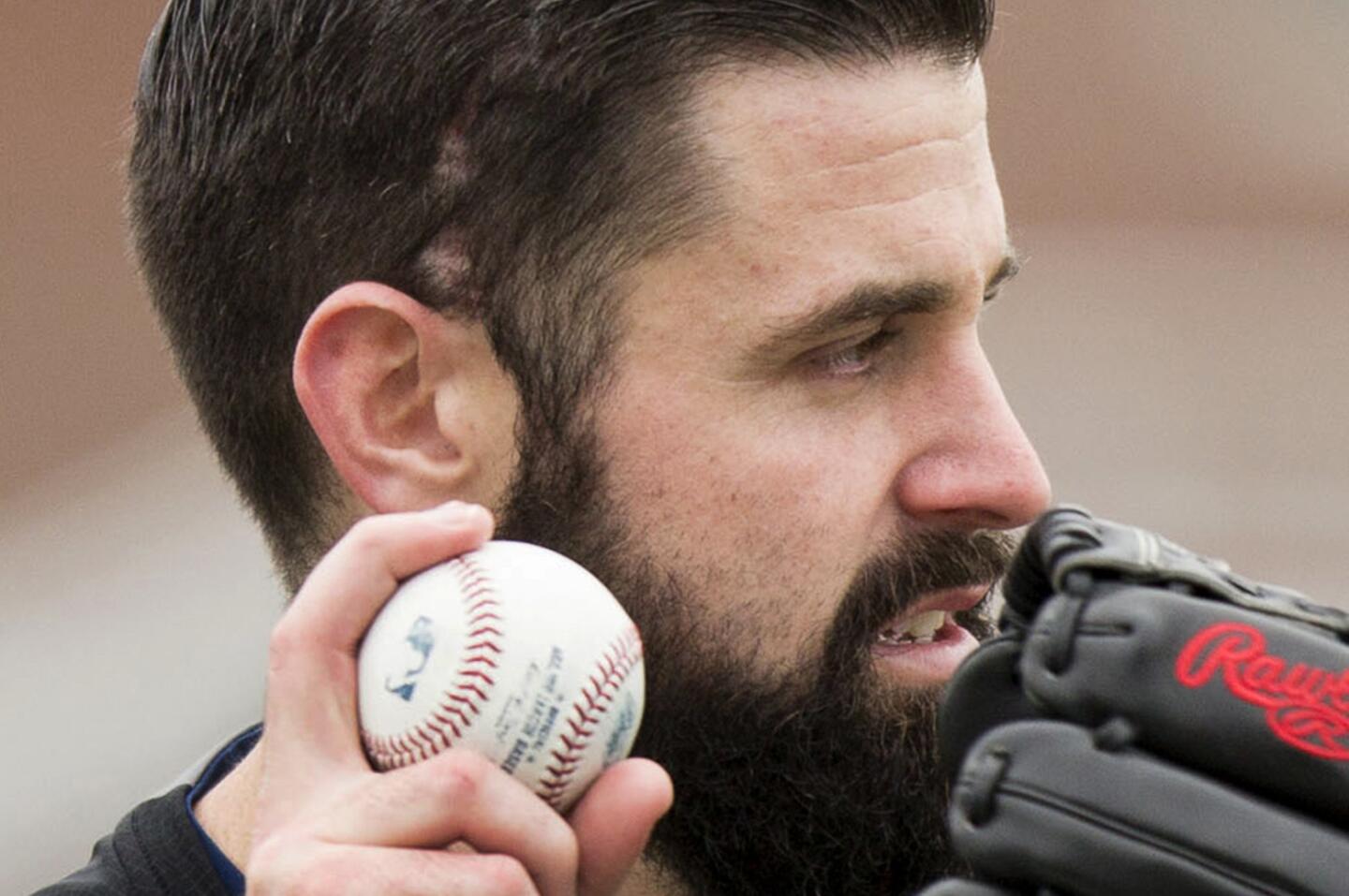 Angels starting pitcher Matt Shoemaker has a visible scar above his right ear after he was hit in the head by a line drive last Sept. 4.