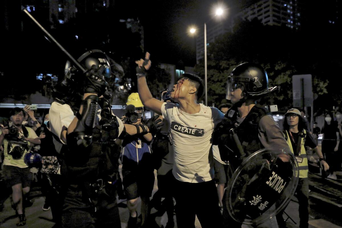 A bleeding man reacts as he is taken away by police outside Kwai Chung police station in Hong Kong on July 31. Protesters clashed with police again in Hong Kong on Tuesday night.