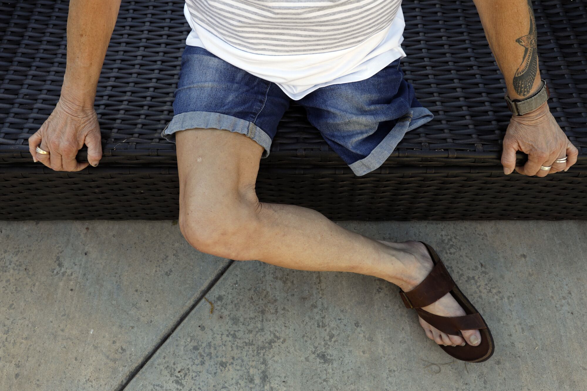 A seated person whose left leg is missing