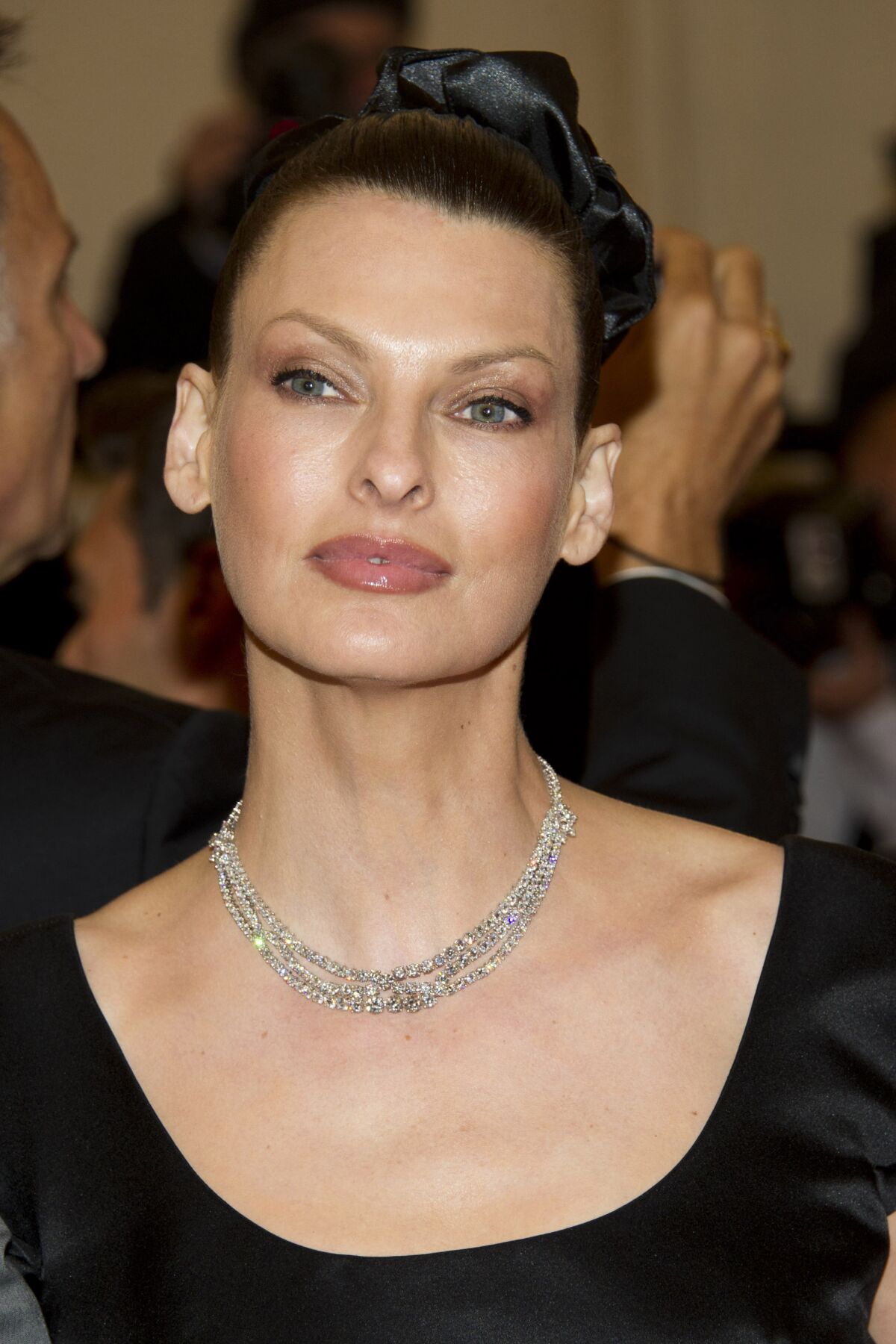 Why Linda Evangelista Is Suing After Coolsculpting Procedure Los