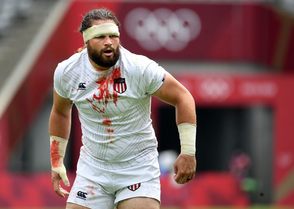 U.S. rugby player Danny Barrett competes with a bloodied jersey after suffering a cut near his eye.