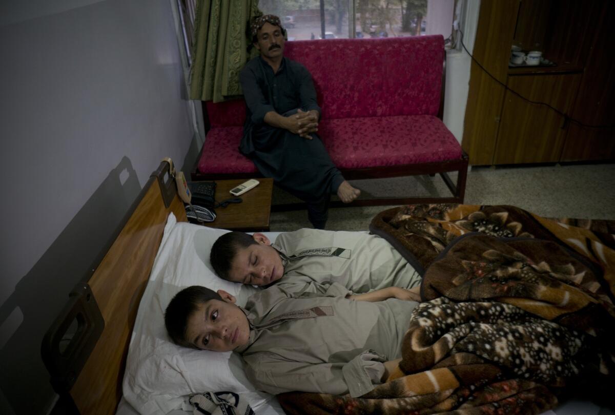En esta fotografía los niños paquistaníes Abdul Rasheed, de 9 años, al frente, y Shoaib Ahmed, de 13 años, están exhaustos en la cama de un hospital en Islamabad, Paquistán. (Foto AP/B.K. Bangash)