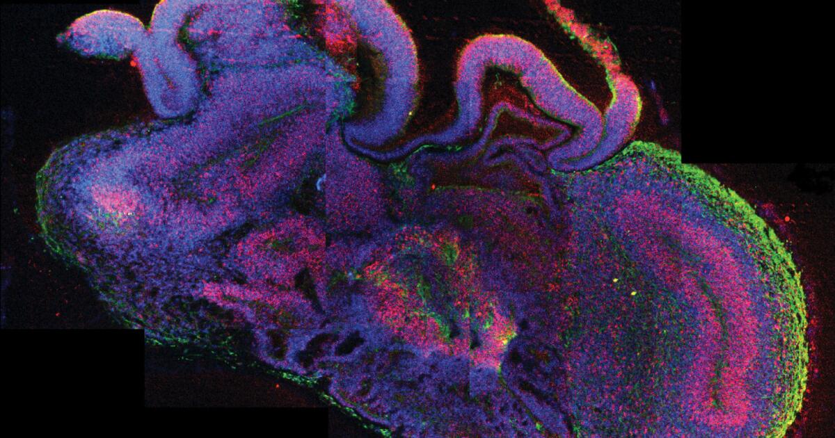 Scientists grow tiny brain 'organoids' for study
