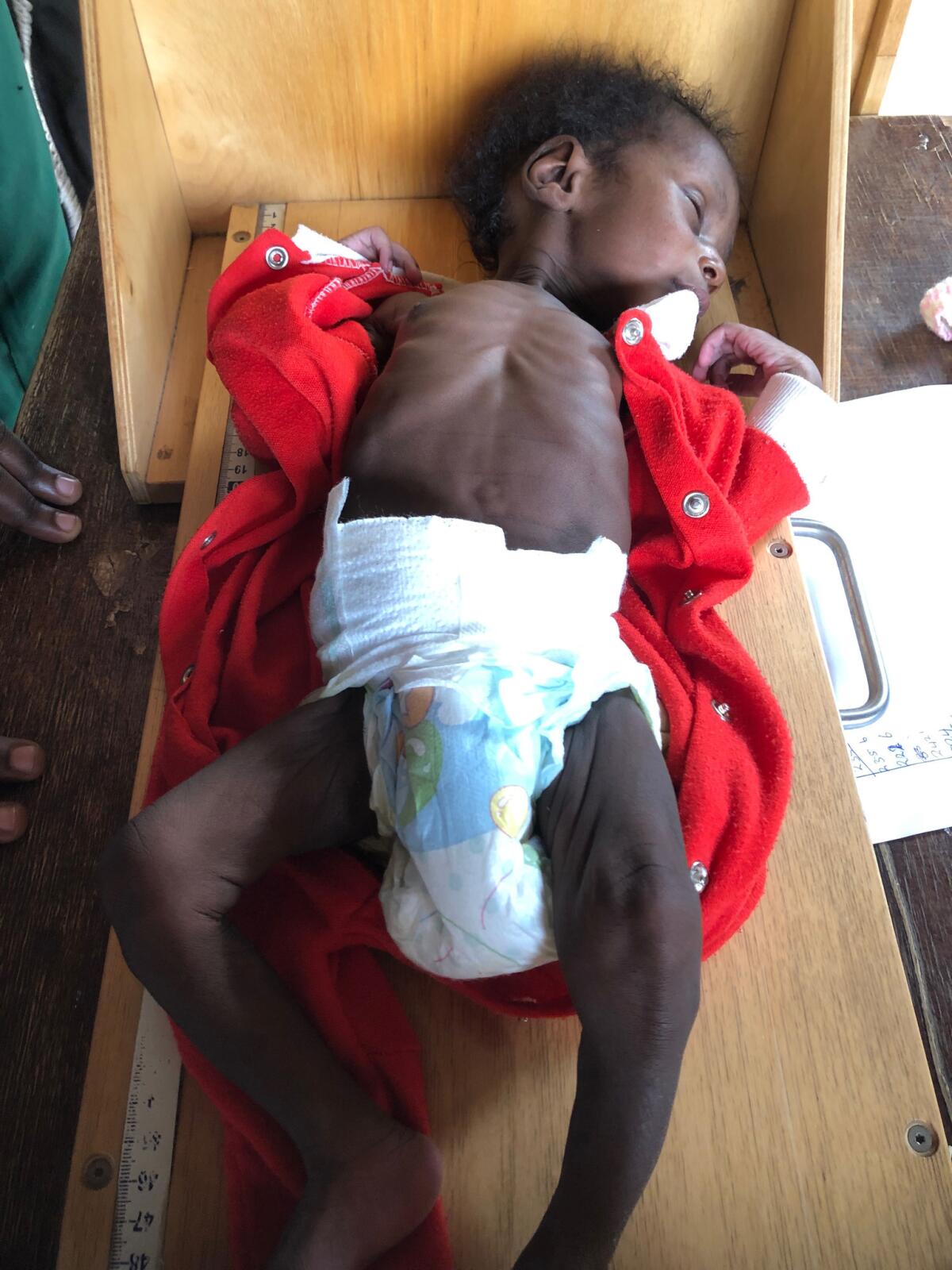 Sufiyan, a 1-month-old from an orphanage in Kaduna, Nigeria, was examined in the pediatric unit at the Barau Dikko Teaching Hospital.