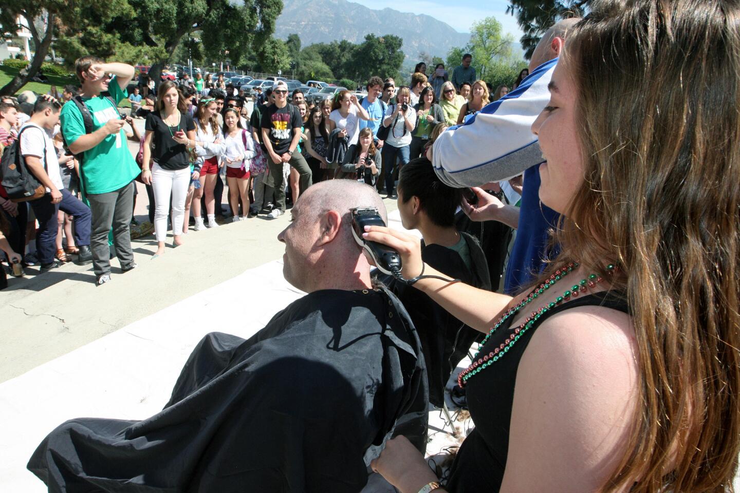 Photo Gallery: Hair loss for a cause