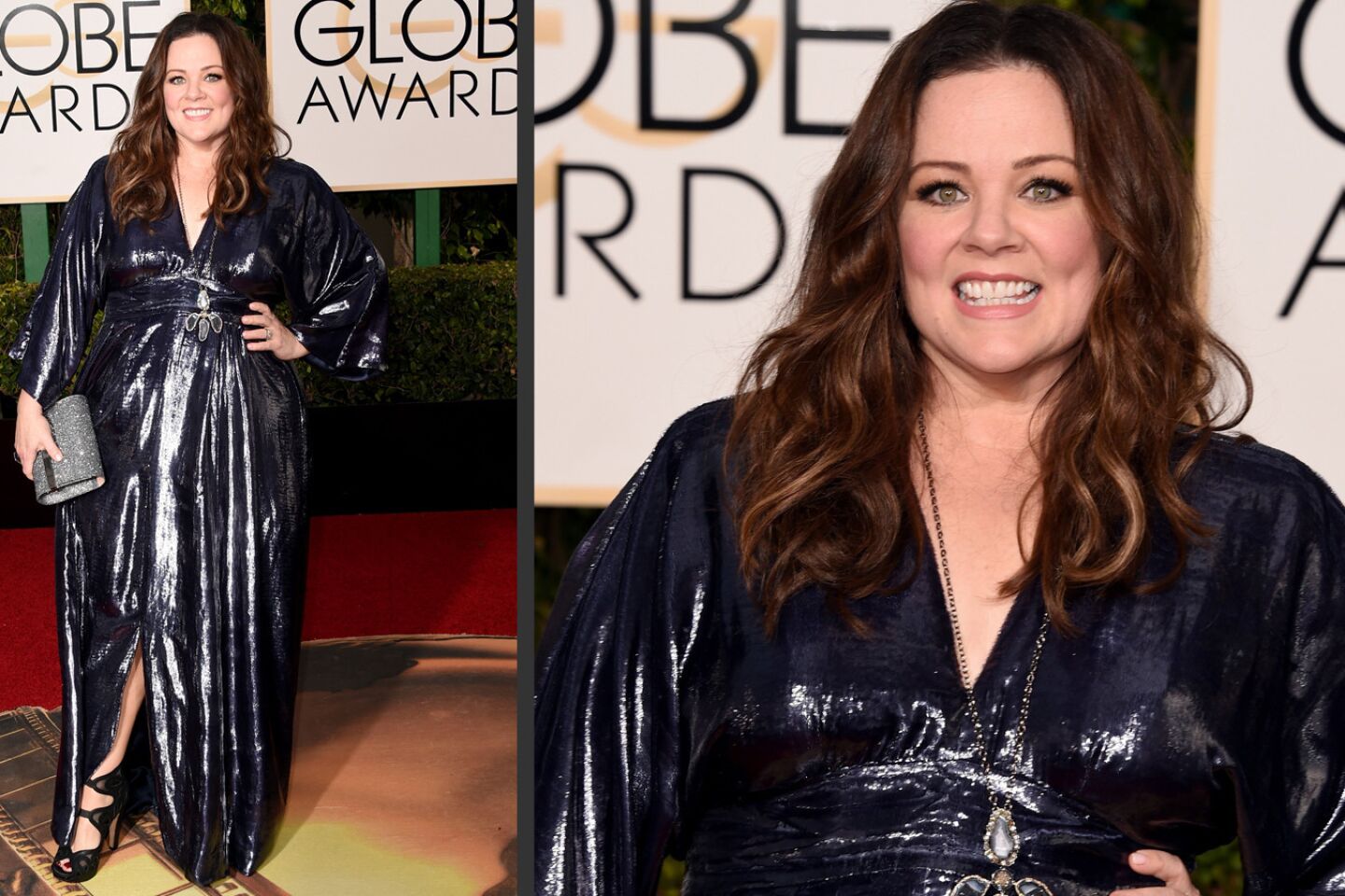 Golden Globes 2016: Worst dressed