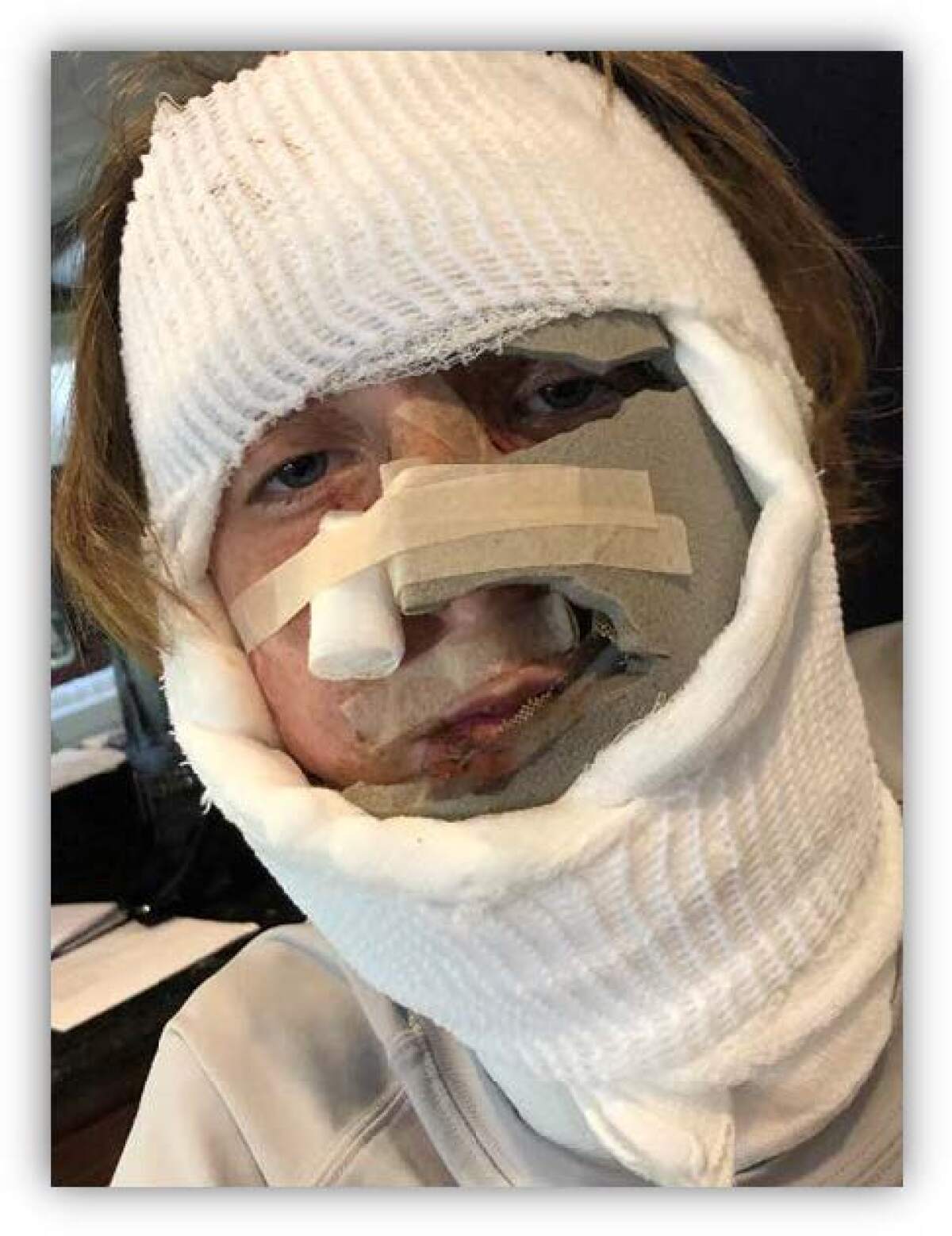 Priest Rivera after allegedly suffering wounds from a science experiment gone wrong.