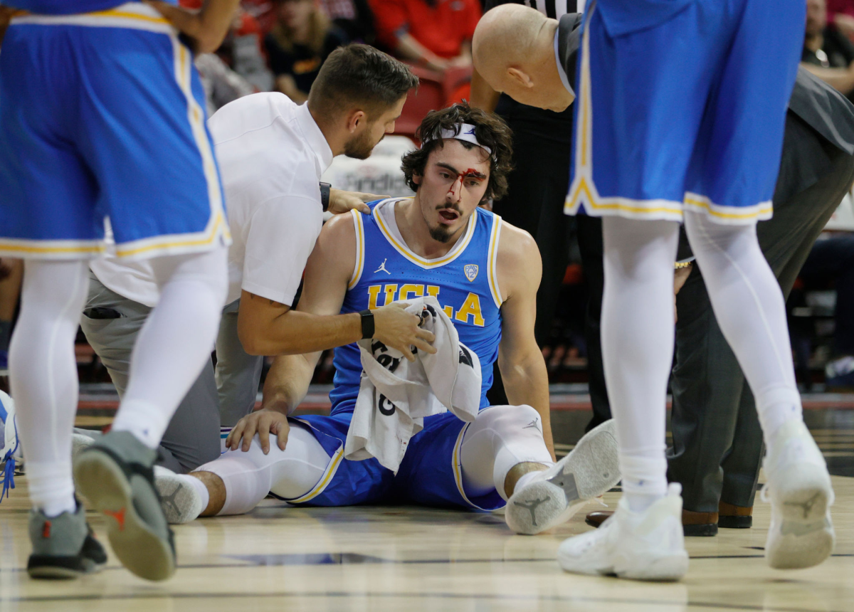 UCLA's Jaime Jaquez Jr. is checked on by a trainer, left, and coach Mick Cronin after Jaquez collided with Myles Johnson.