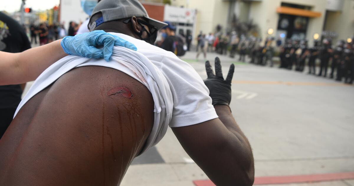 By firing rubber bullets at protesters, police risk killing, blinding or maiming them