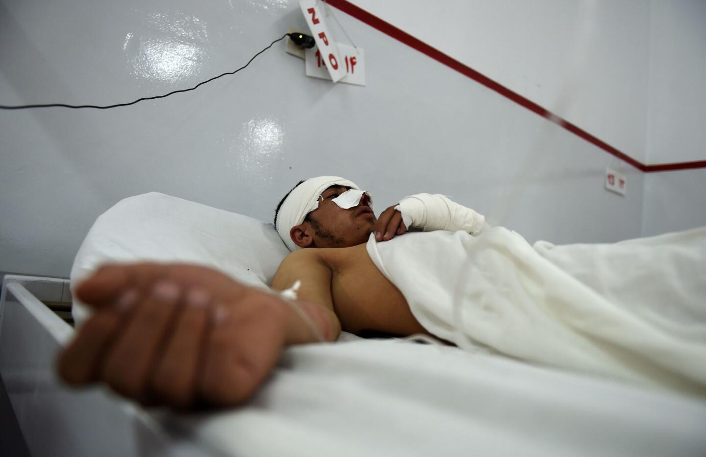 A wounded Afghan police cadet receives treatment at an Italian aid organization hospital in Kabul, following a suicide bomb attack on a convoy of buses transporting police cadets in the Afghan capital.