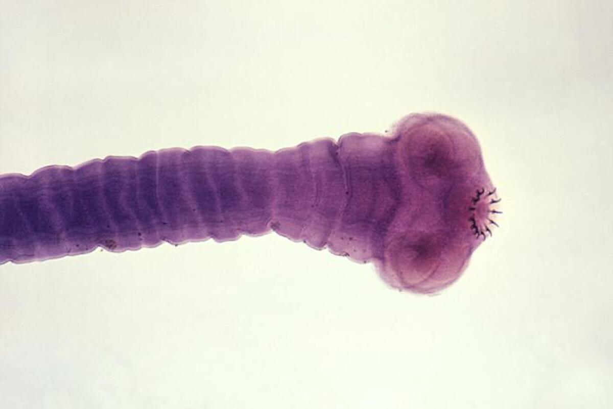 A photomicrograph of the parasitic pork tapeworm Taenia solium.