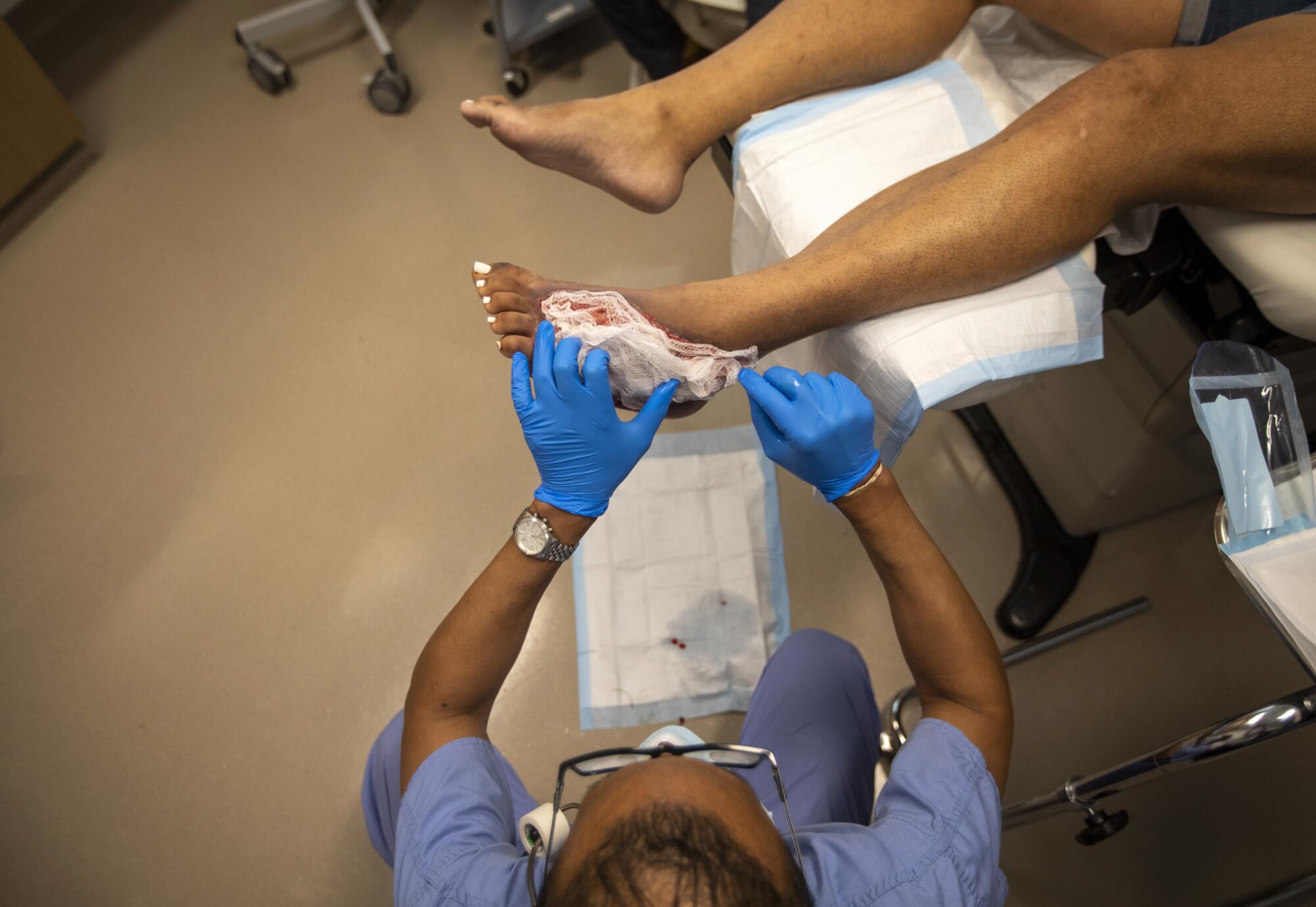 Dr. Myron Hall dresses Sandy Vazquez foot after a procedure at the wound care clinic at Martin Luther King, Jr. 