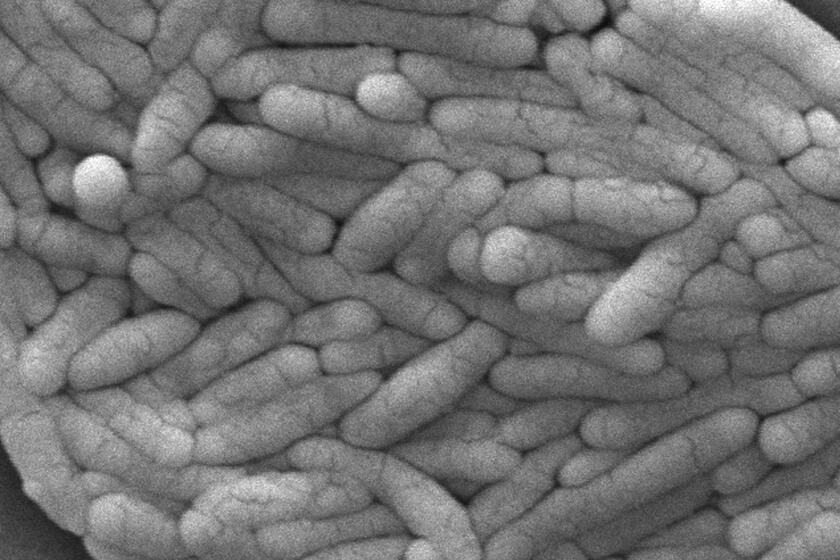 Esta imagen de 2009 tomada con microscopio electrónico, provista por los Centros de Control y Prevención de Enfermedades, muestra un cúmulo de bacterias Gram-negativas Salmonella typhimurium aislado de un cultivo puro. Los productores de pollos deberán reducir la bacteria salmonela en ciertos productos a niveles muy bajos para prevenir la intoxicación alimenticia, según una norma emitida el viernes 26 de abril de 2024 por el Departamento de Agricultura de Estados Unidos. (Janice Haney Carr/CDC via AP)