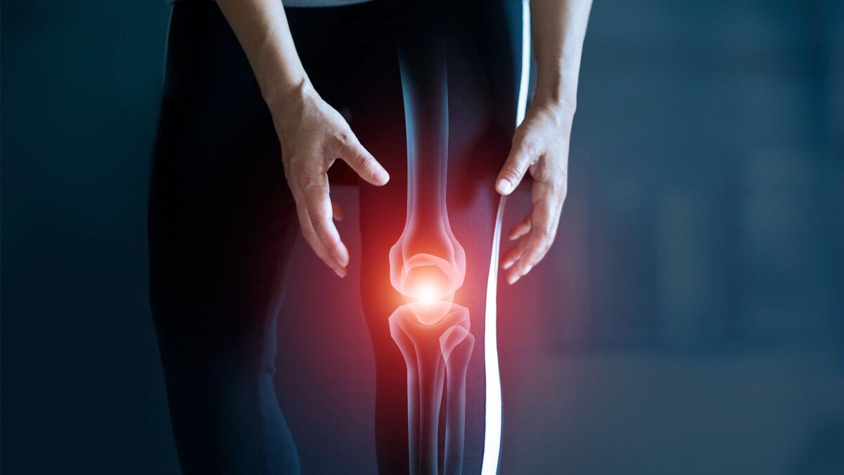 Woman suffering from pain in knee, Injury from workout and osteoarthritis, Tendon problems and Joint inflammation.
