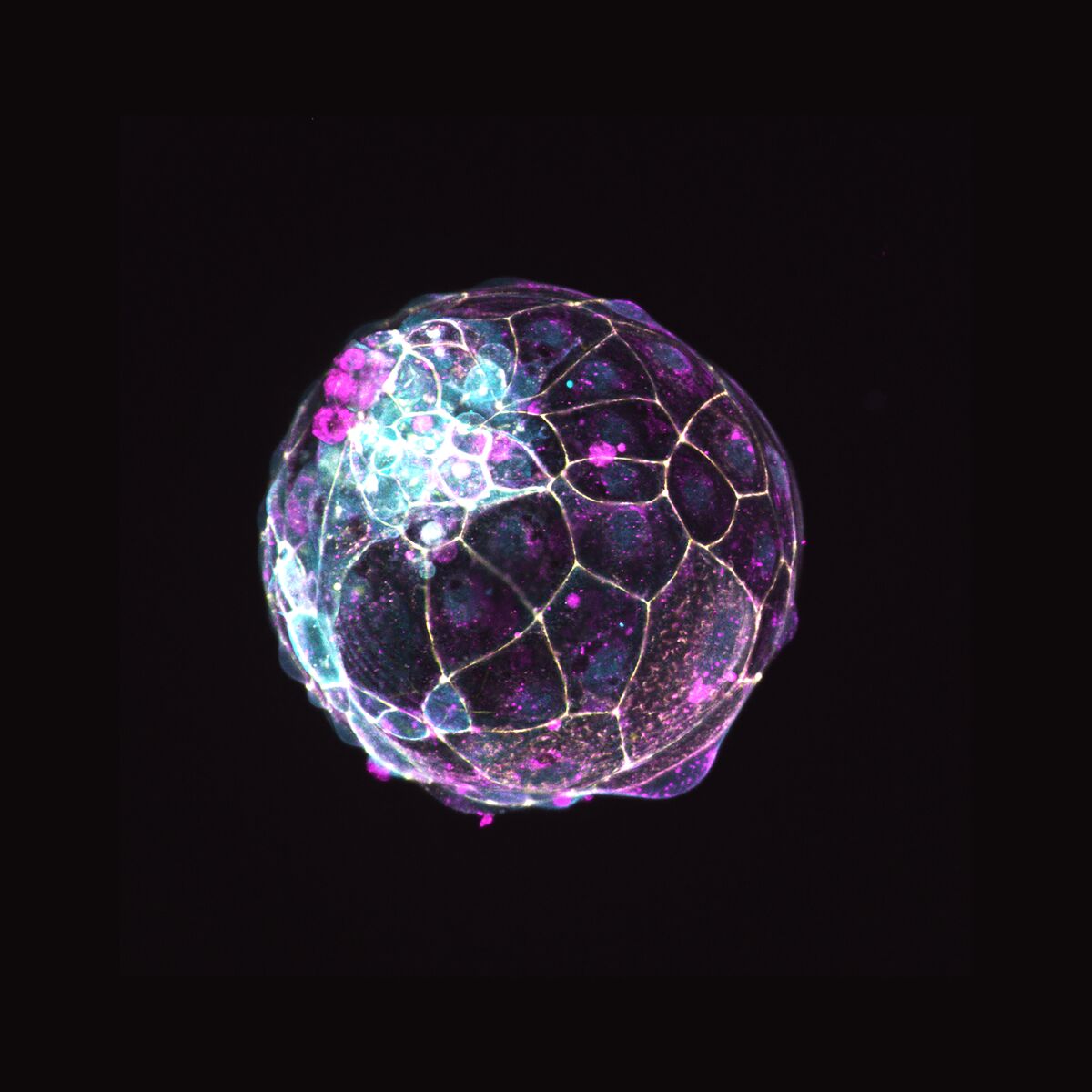 Scientists created this structure that mimics a human "blastoid,”  a ball of cells that form within a week of fertilization. 