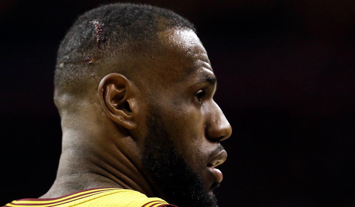Cleveland Cavaliers forward LeBron James got a cut in his head during the second half of Game 4 of the NBA Finals against the Golden State Warriors on Thursday. James cut his head when he collided with a TV cameraman after a hard foul.