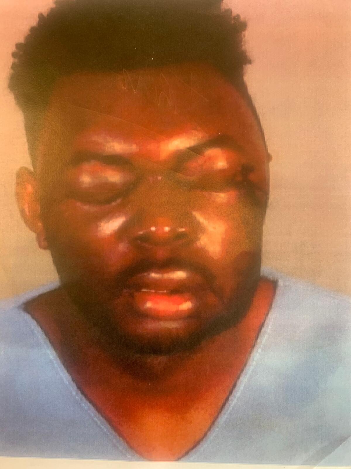 A man with closed, swollen eyes and bruises on his face