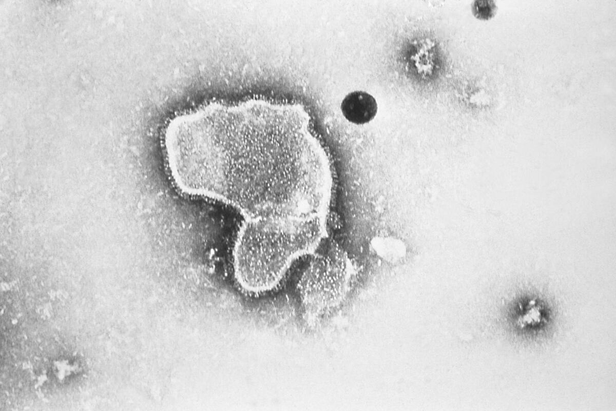 An electron micrograph of RSV. 