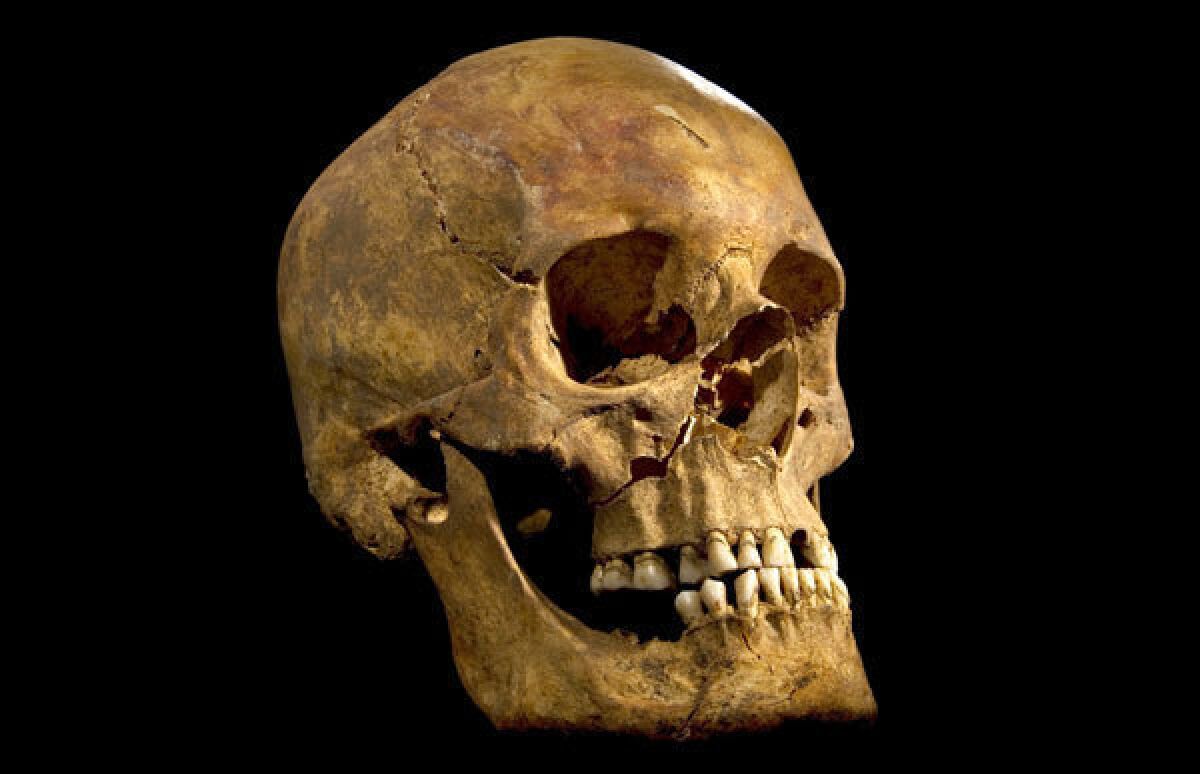 The skull of the skeleton found beneath a parking lot in northern England, which DNA tests have confirmed was that of King Richard III.