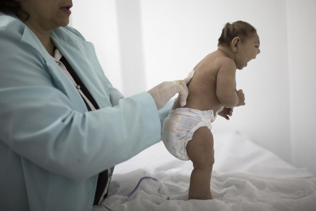Lara, who is less than 3 months old and was born with microcephaly, is examined by a neurologist at the Pedro I Hospital in Campina Grande, Brazil, on Feb. 12.