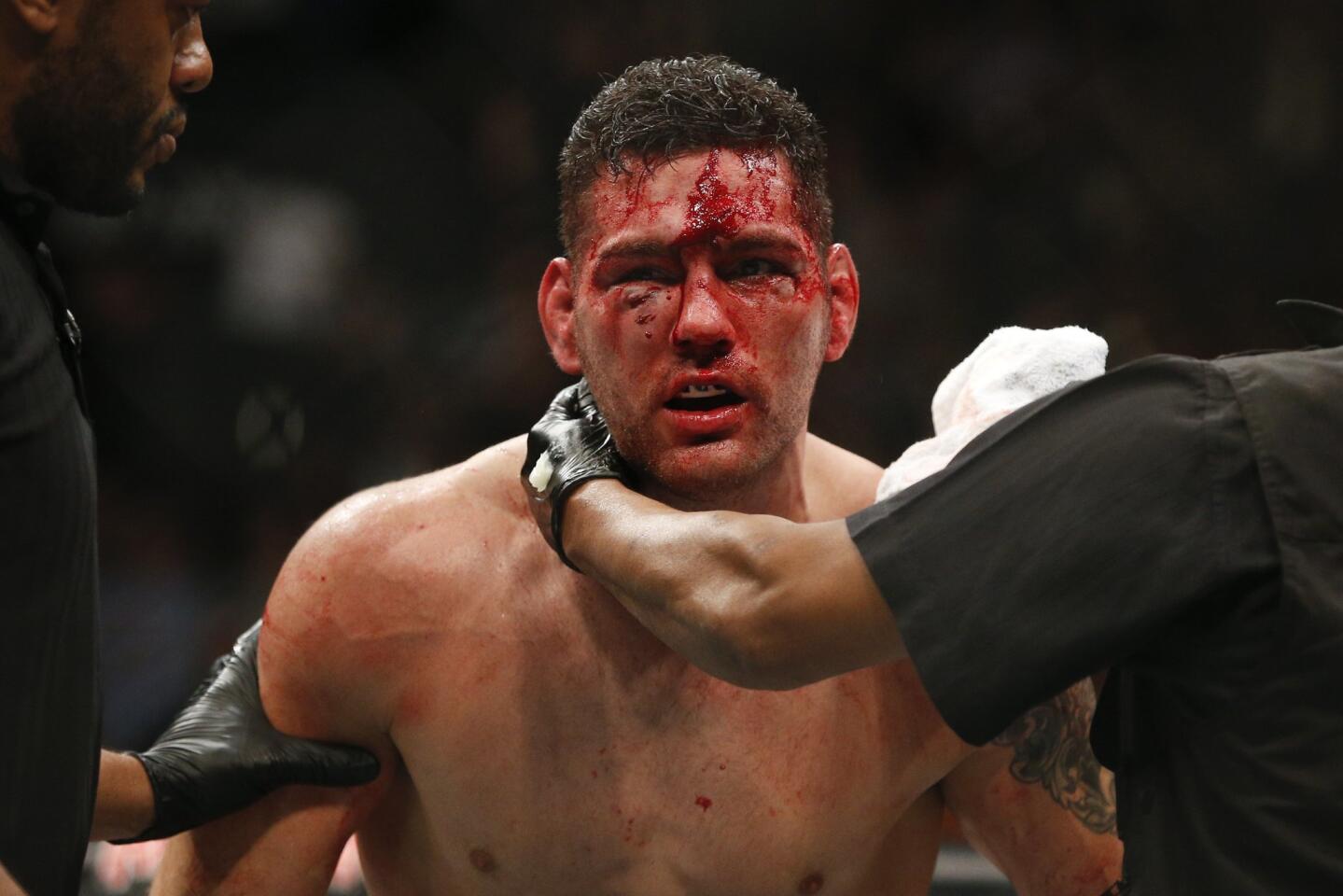 Chris Weidman,