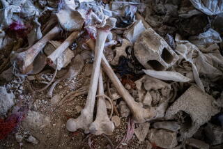 Bones.
