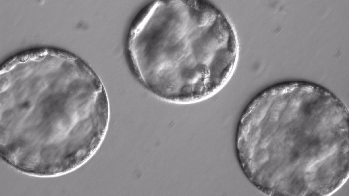 Human embryos are shown developing into blastocysts after being injected with a gene-correcting enzyme and sperm carrying a mutation for a potentially fatal disease of the heart muscle.