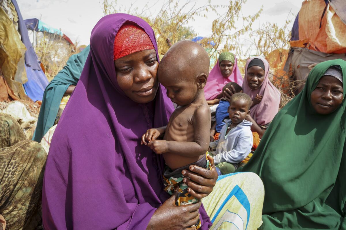 Woman in Somalia holds her malnourished 1-year-old child