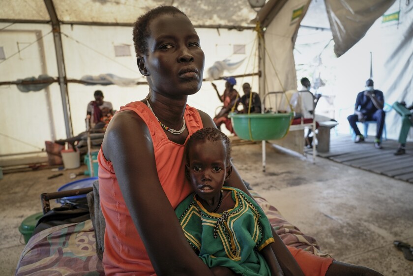 Nyayiar Kuol holds her severely malnourished 1-year-old daughter Chuoder Wal in a hospital run by Doctors Without Borders.