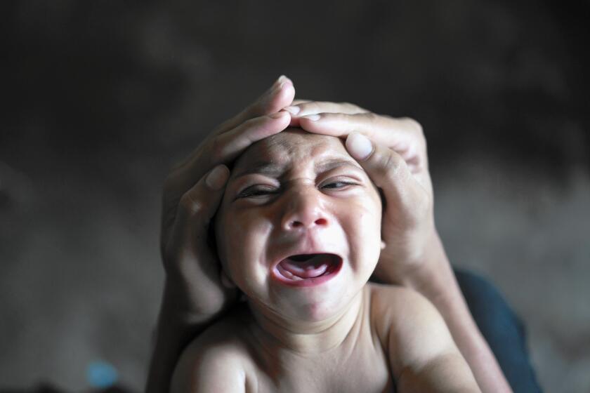 A baby boy is attended to in Bonito, Brazil on Jan. 30. The child was born with microcephaly, and screams uncontrollably for long stretches.