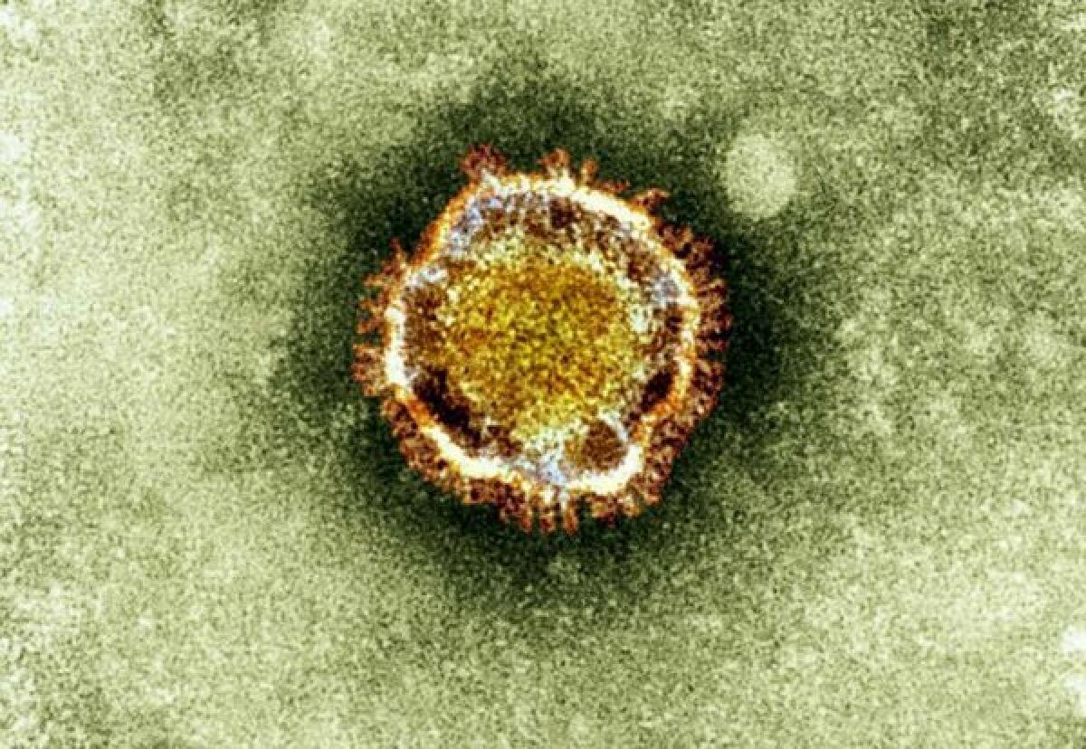 An image of a coronavirus cell. Joanne Wright, the lone Republican vying for the 34th Congressional District in Los Angeles, circulated a conspiracy theory about the origins of the new coronavirus in a now-deleted tweet.