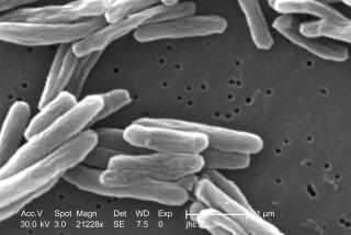 Esta imagen de microscopio de 2006 proporcionada por los Centros para el Control y la Prevención de Enfermedades muestran a la Mycobacterium tuberculosis, bacteria que causa la enfermedad de tuberculosis. (Janice Carr/CDC vía AP)