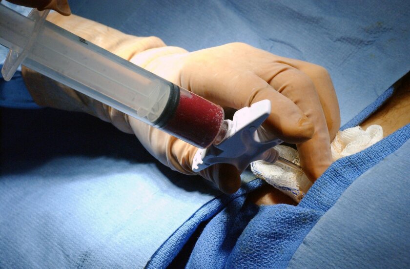 A bone marrow harvest. The procedure consists of inserting a large-gauge syringe into an area of the hip and extracting the bone marrow. It is transfused into the recipient, and helps to recreate and replenish T-cells and the white and red blood cells killed while undergoing chemotherapy.