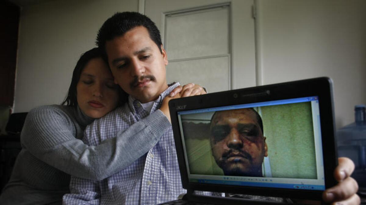 Gabriel Carrillo y su entonces novia -- ahora su esposa -- muestran una foto que ella tomó de Carrillo unos pocos días después de que fue brutalmente golpeado por los oficiales del Sheriff del Condado de Los Angeles en la Cárcel Central para Hombres.