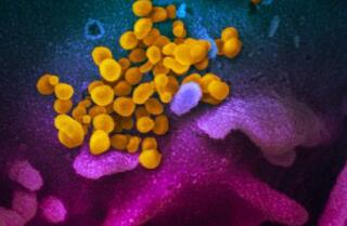 En bild från ett svepande elektronmikroskop visar det nya coronaviruset (gult) som växer fram från ytan av celler (blått och rosa) som odlats i laboratorium.