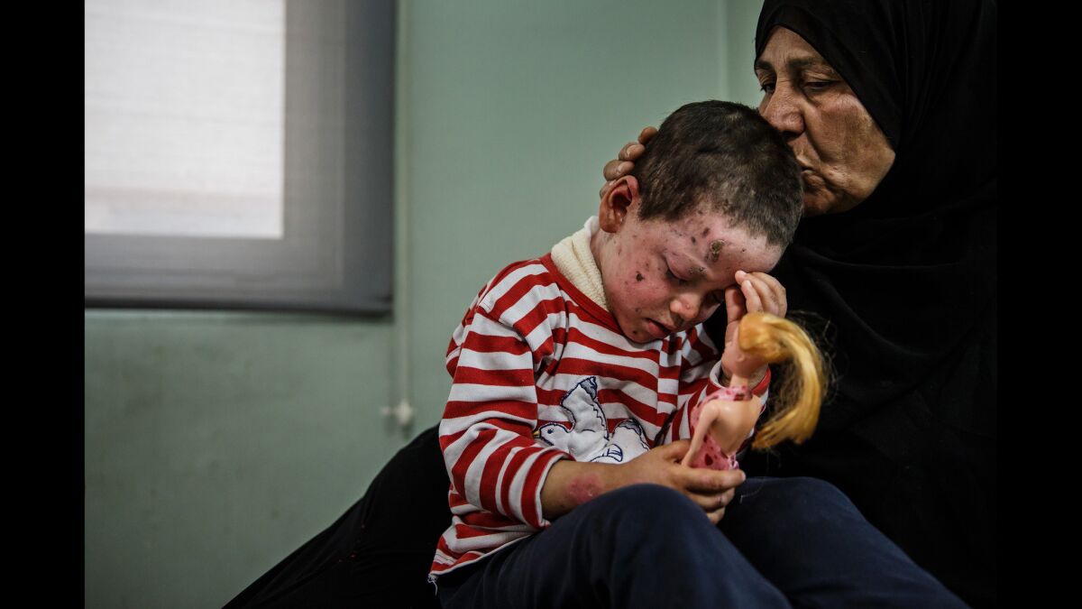 Alia Ali kisses her granddaughter Hawra Hassan, 4, who suffered shrapnel wounds to her face, neck and left eye, along with a broken foot, from the March 17 U.S. airstrike on Mosul's Jadidah neighborhood.