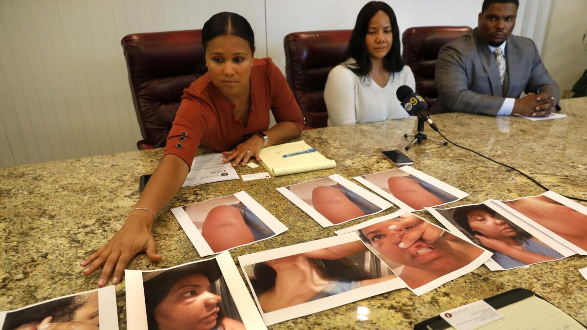 Katrina Ross, center, with her attorneys, Britany Engelmann, left, and Rodney Diggs, right, show photographs of Ross' injuries from an assault in April.