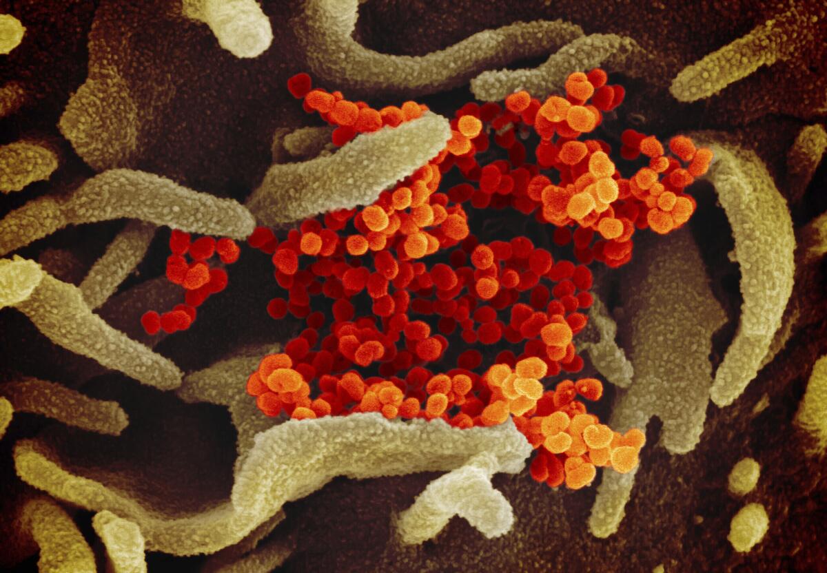 A close-up image of an orange coronavirus emerging from the surface of green cells