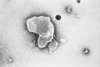 FILE - This 1981 photo provided by the Centers for Disease Control and Prevention (CDC) shows an electron micrograph of Respiratory Syncytial Virus, also known as RSV. New research announced by Pfizer on Tuesday, Nov. 1, 2022, showed vaccinating pregnant women helped protect their newborns from the common but scary respiratory virus that fills hospitals with wheezing babies each fall. (CDC via AP, File)