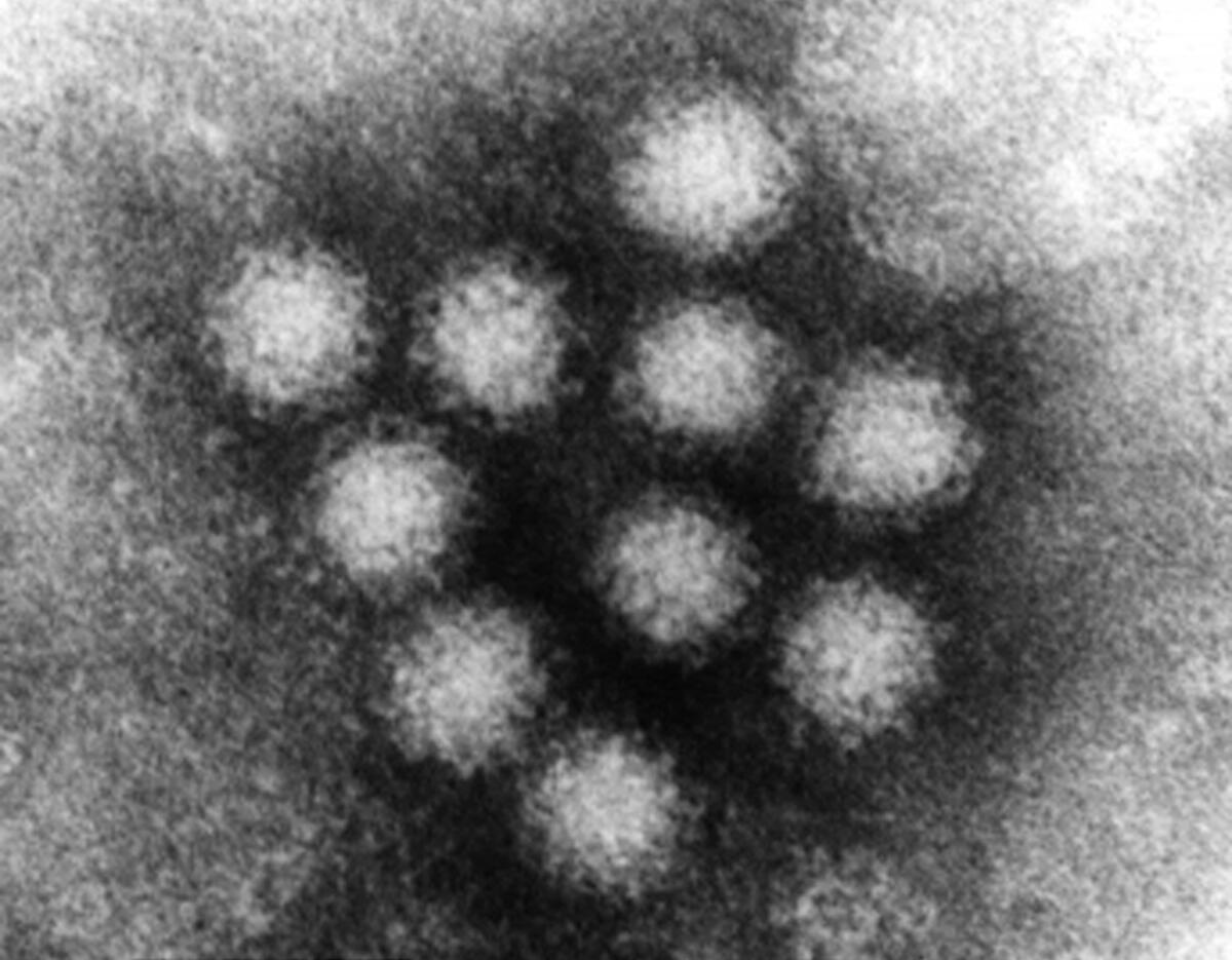 The U.S. EPA provided undated electron beam micrograph showing a norovirus, also known as Norwalk Virus. 