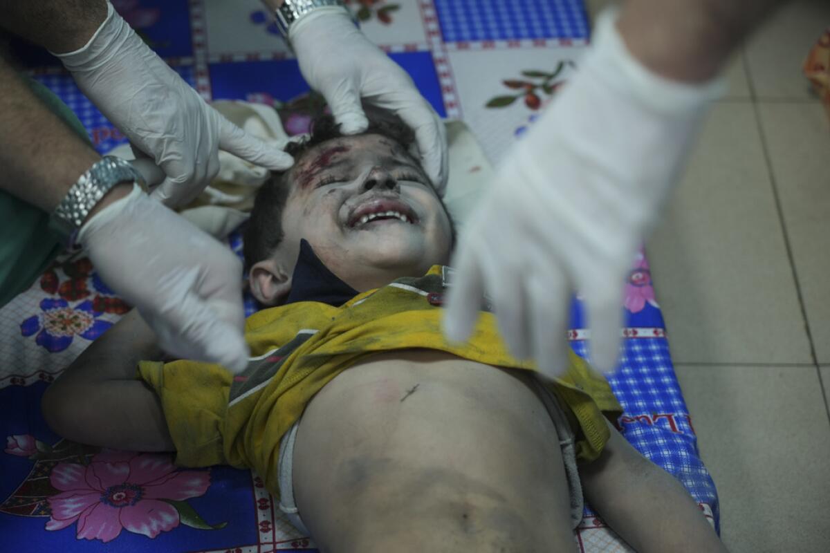 Un niño palestino herido tras un bombardeo israelí 