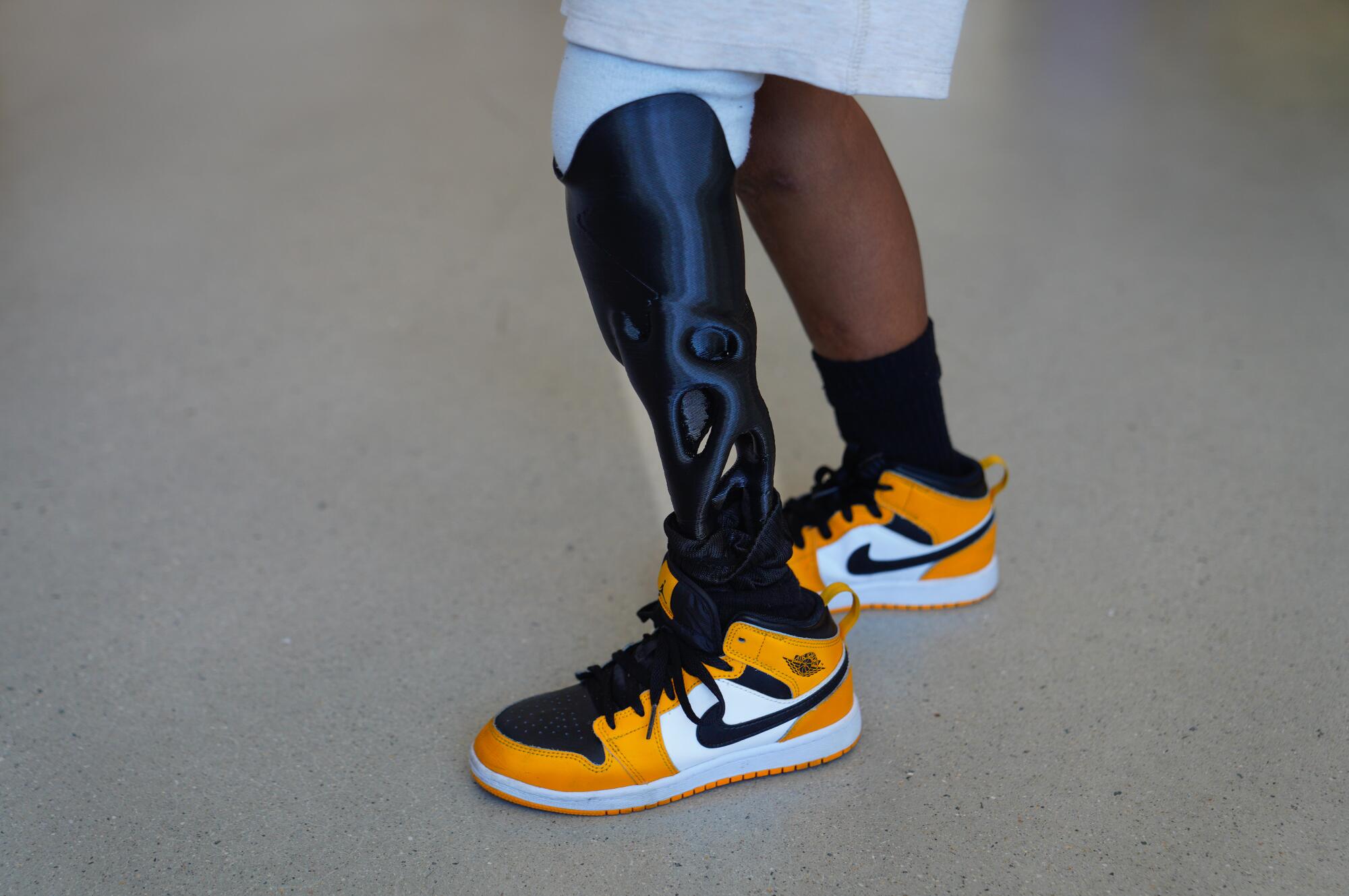Jonah Villamil takes his new 3-D printed prosthetic limb for a test walk.