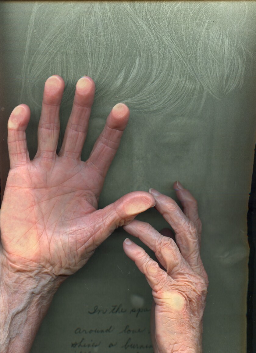 La imagen vertical muestra el contorno fantasmal del rostro, frente al cual está la mano de una anciana.
