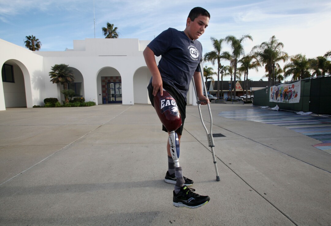 Andrew Seelhoff, 14 ans, s'entraîne à marcher sur sa première jambe prothétique en novembre 2014 