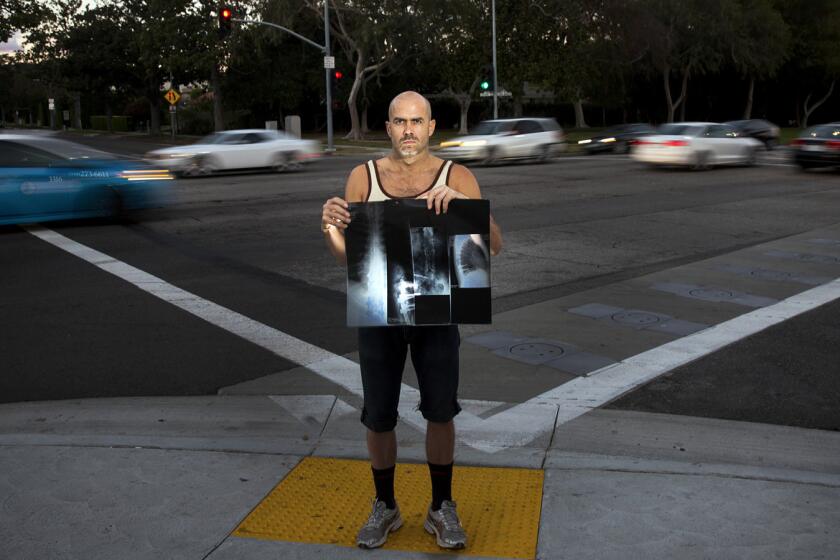 Hit-and-run victim Paul Livingston is photographed holding X-rays of his back at the intersection of Santa Monica Boulevard and North Crescent Drive, where he was struck while riding his bike in 2011.