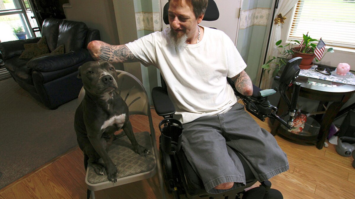 A Germ From A Dog S Mouth Led To Amputation Researchers Blamed A Gene Change Los Angeles Times