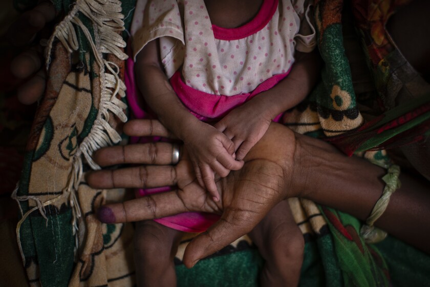 FILE - In this Tuesday, May 11, 2021 file photo, Abeba Gebru, 37, from the village of Getskimilesley, holds the hands of her malnourished daughter, Tigsti Mahderekal, 20 days old, in the treatment tent of a medical clinic in the town of Abi Adi, in the Tigray region of northern Ethiopia. The United States estimates that up to 900,000 people in Ethiopia’s Tigray region now face famine conditions amid a deadly conflict, even as the prime minister says there is “no hunger” there. The hunger crisis in Tigray is the world’s worst in a decade, and the new famine findings are “terrifying,” the head of the U.S. Agency for International Development, Samantha Power, said Friday June 26, 2021, adding that millions more people are at risk. (AP Photo/Ben Curtis, File)